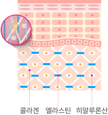피부 진피 속 콜라겐 엘라스틴 히알루론산